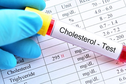 Đái tháo đường và cholesterol có mối liên hệ mật thiết