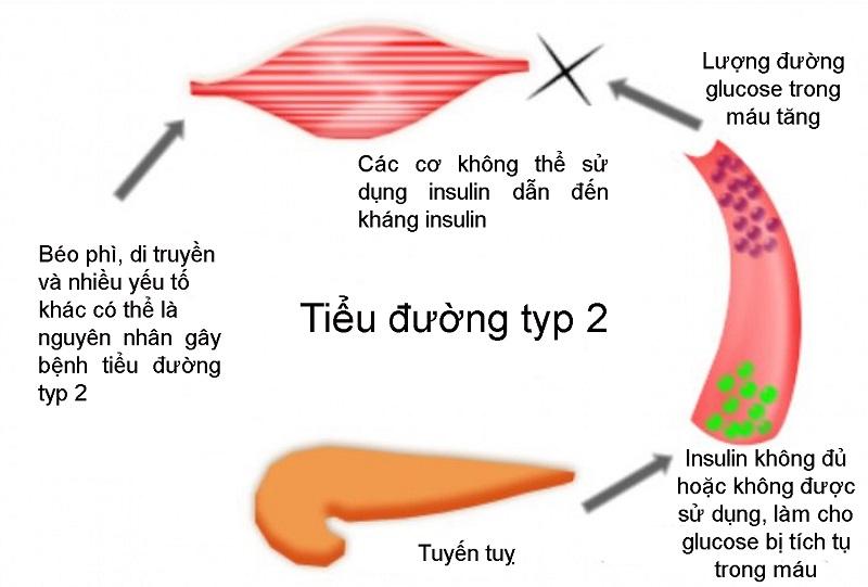 Nguyên nhân và yếu tố nguy cơ